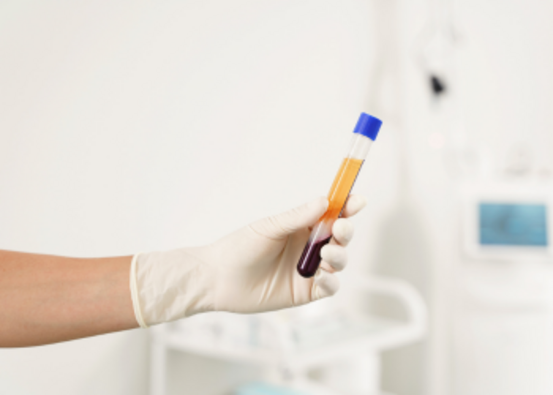 PRP Injections for OA