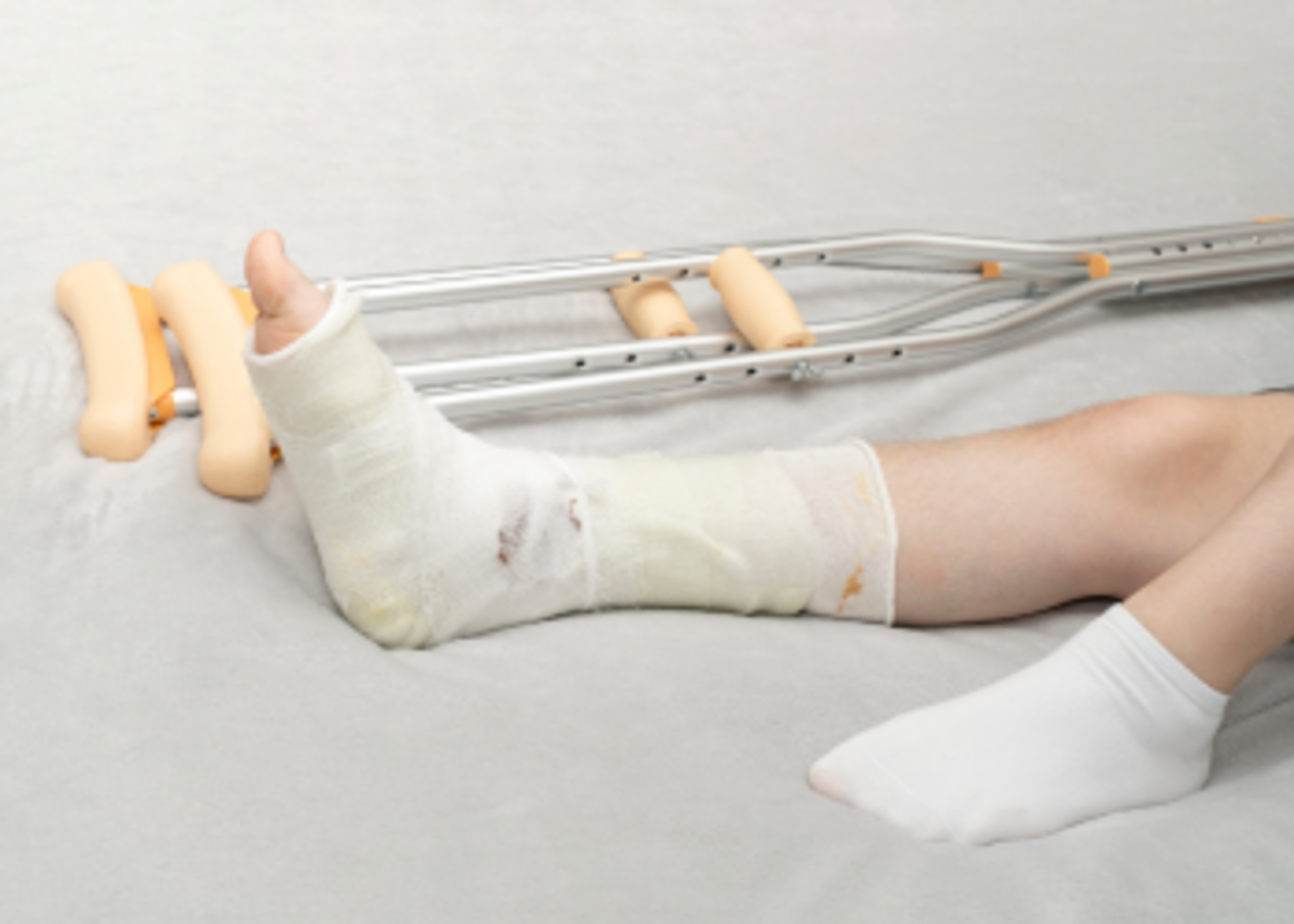 Fractures &amp; Accident