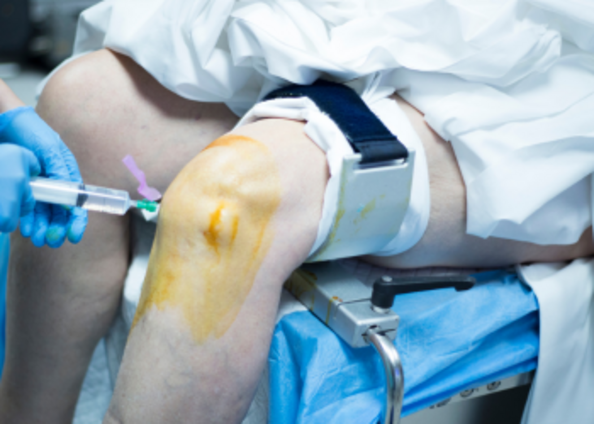 Arthroscopy surgeries(sports injuries)