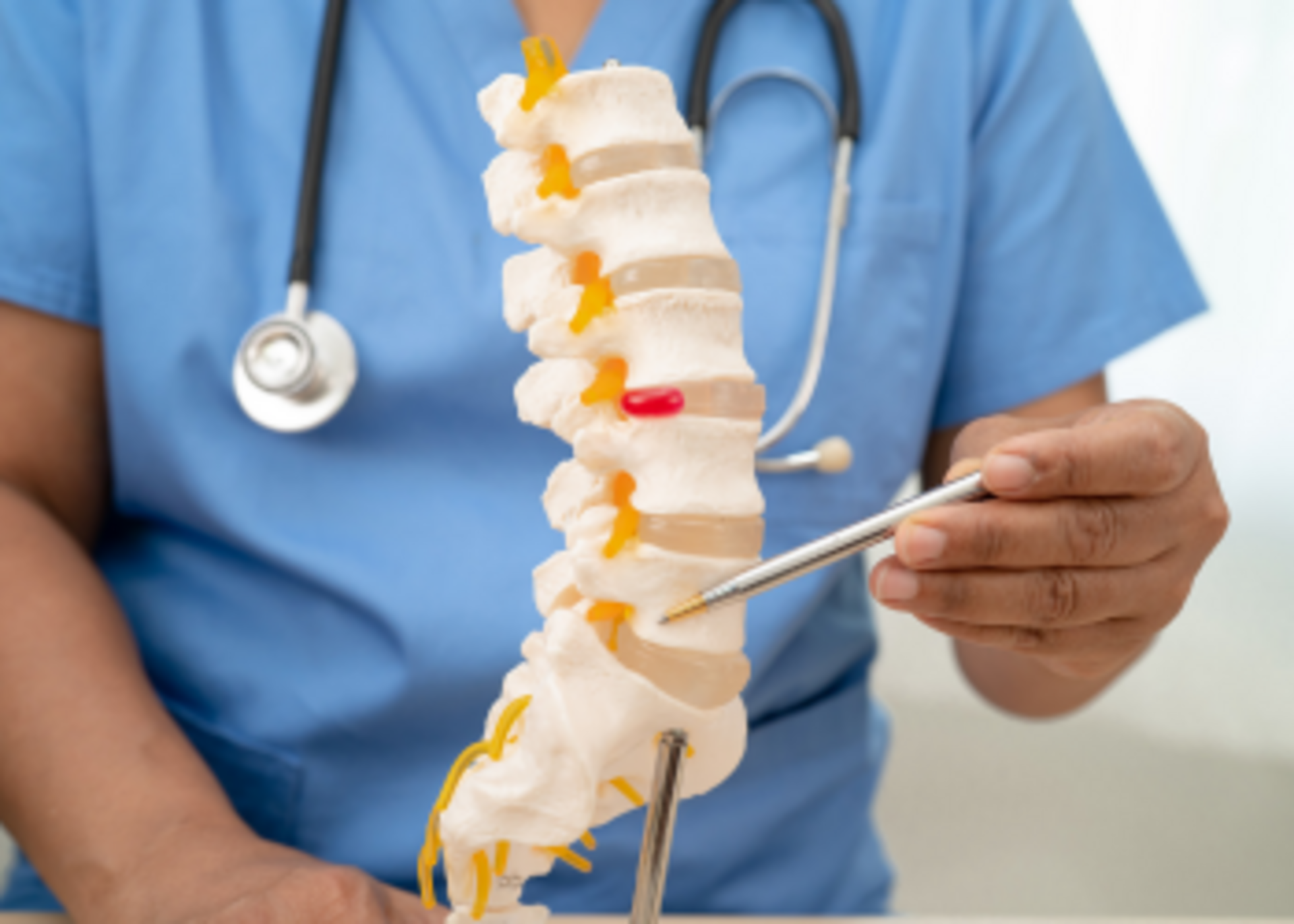 Ankylosing Spondylitis Treatment