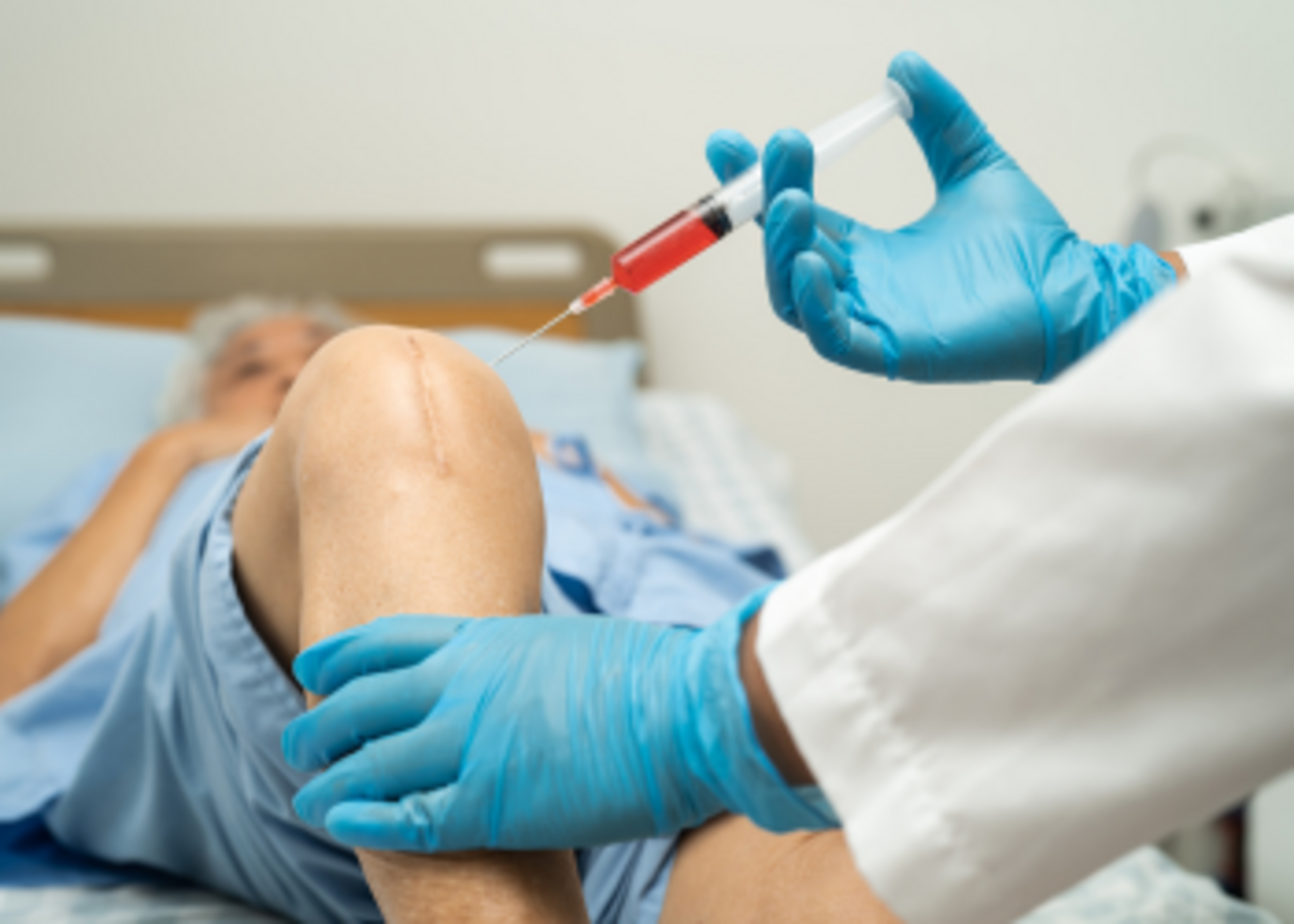 Visscose Injections for OA